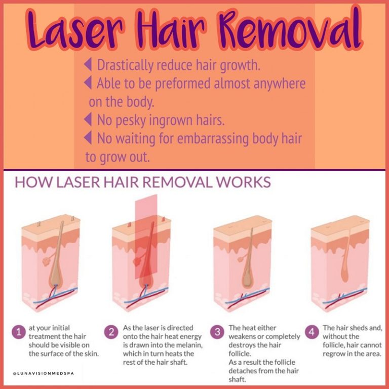 What Do You Call A Person Who Does Laser Hair Removal